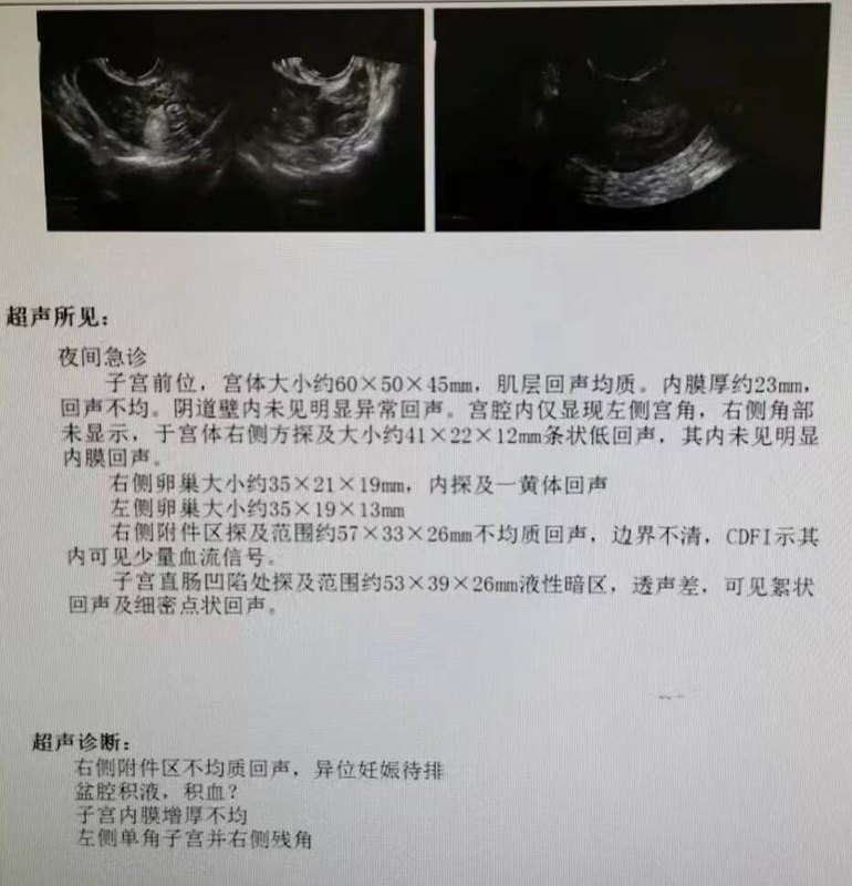 圖文圖片