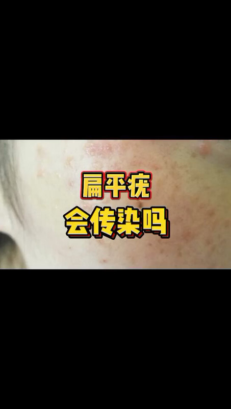 視頻封面
