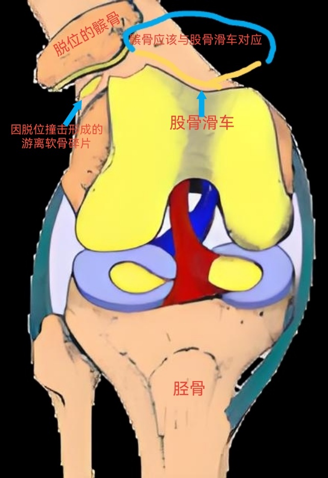 圖文圖片