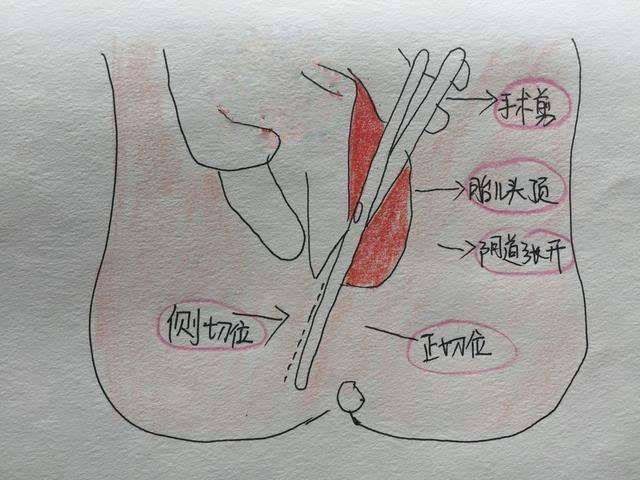 圖文圖片