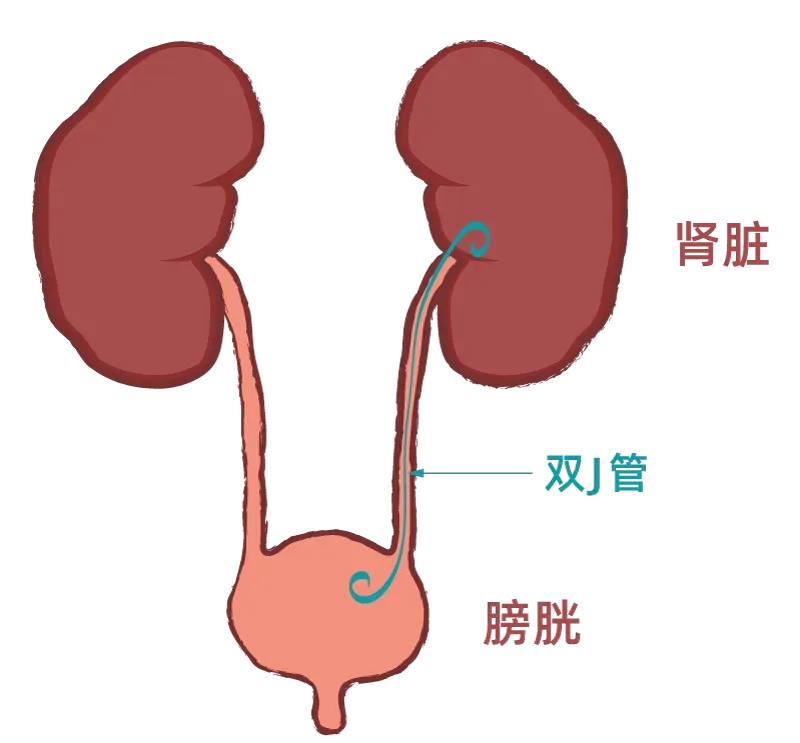 圖文圖片