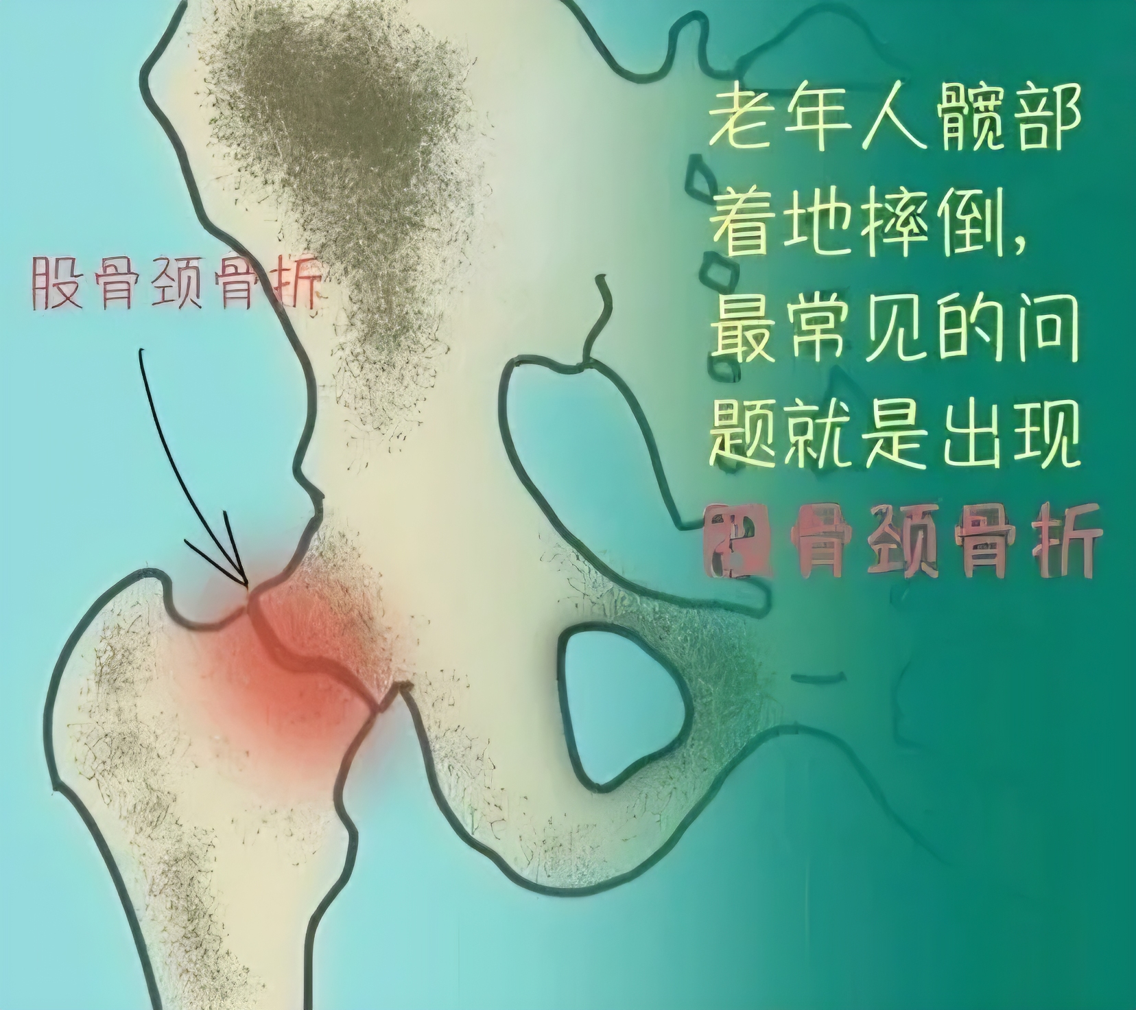 图文图片