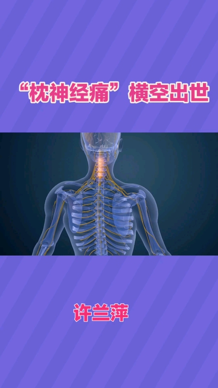 “枕神经痛”横空出世