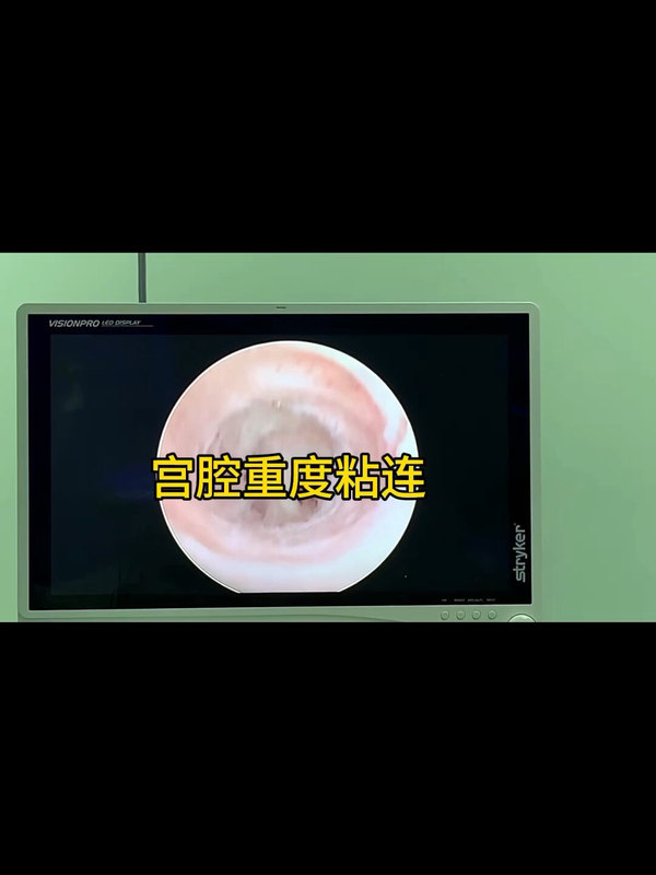 視頻封面