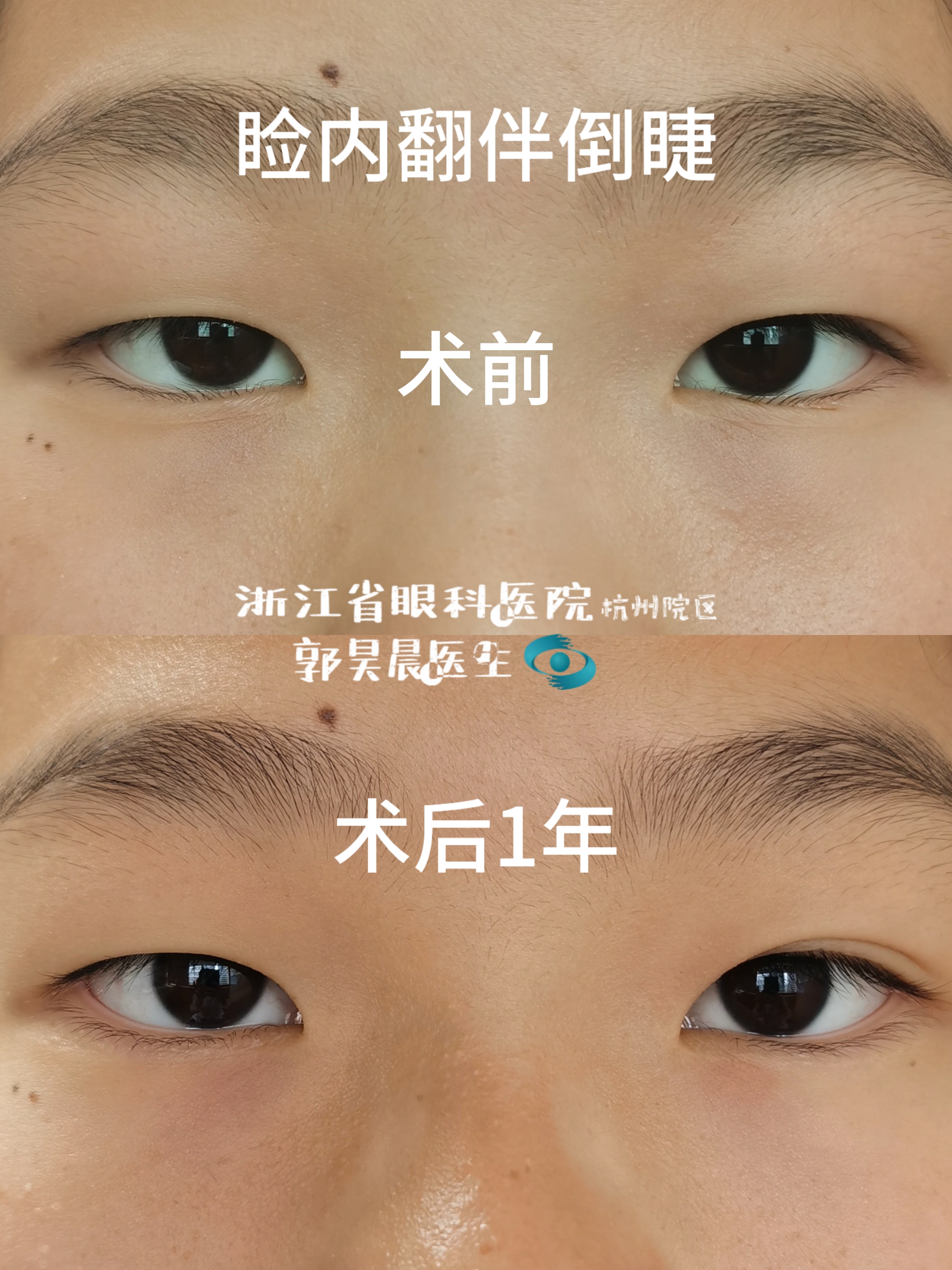 图文图片