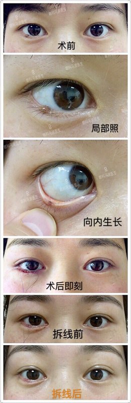 圖文圖片