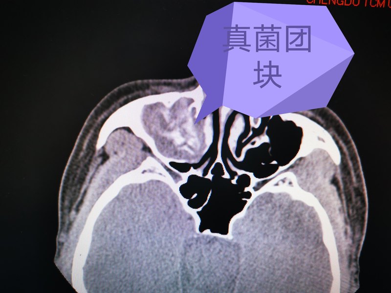圖文圖片