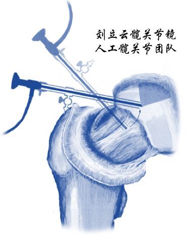 圖文圖片