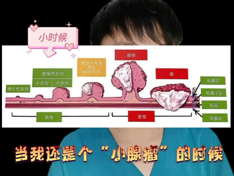 “直肠癌”自述