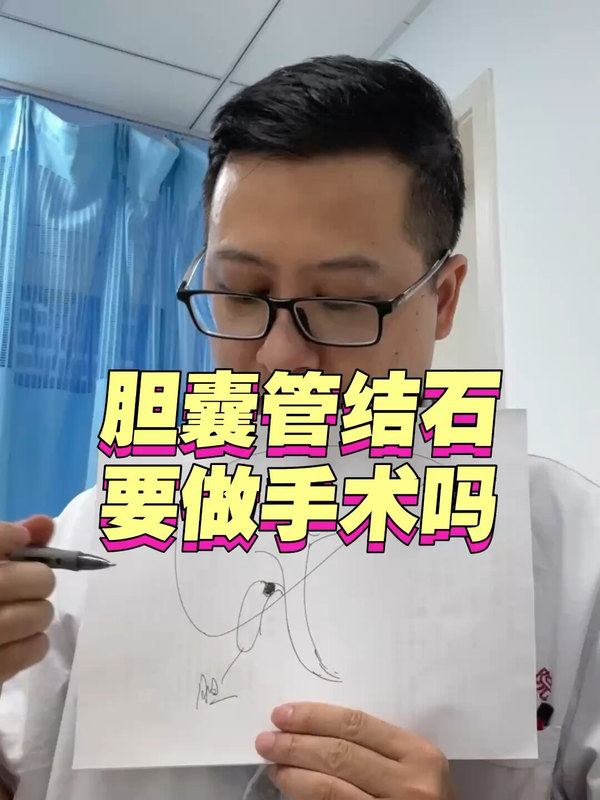 胆囊管结石要做手术吗＃医学科普 ＃胆囊结石