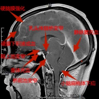 圖文圖片