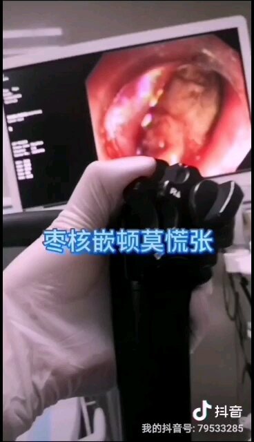 視頻封面