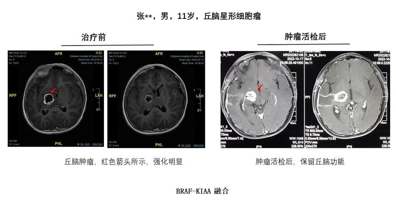 圖文圖片