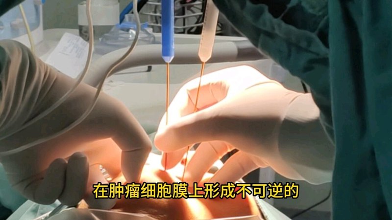視頻封面