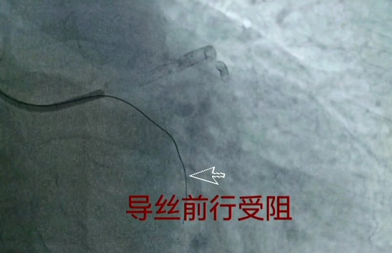 視頻封面