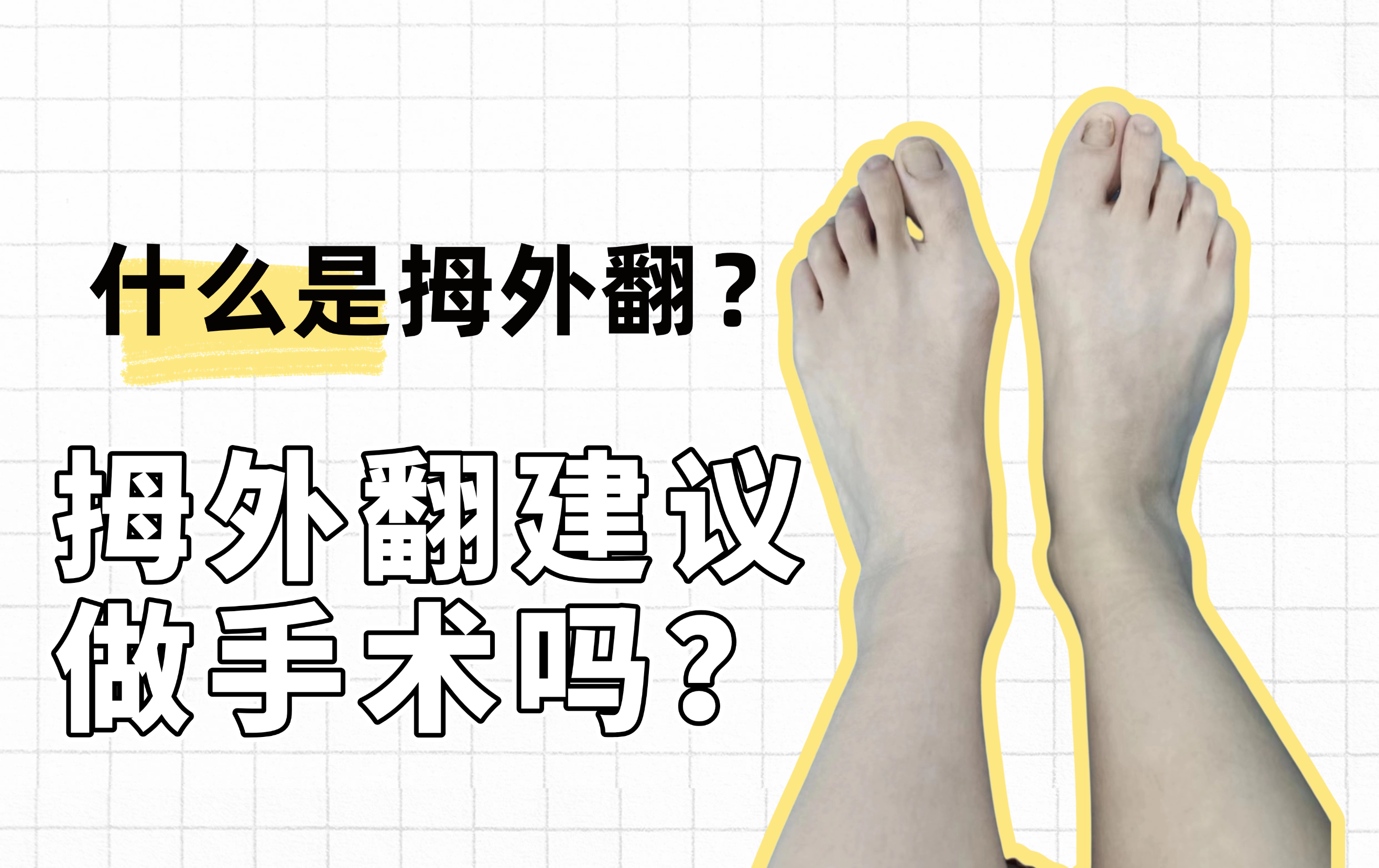 圖文圖片