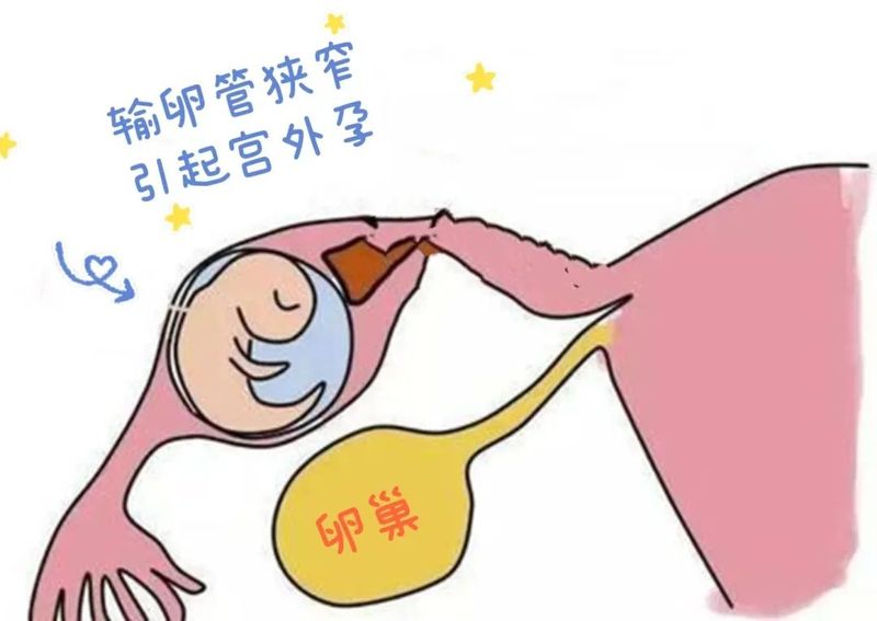 圖文圖片