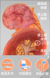 图文图片