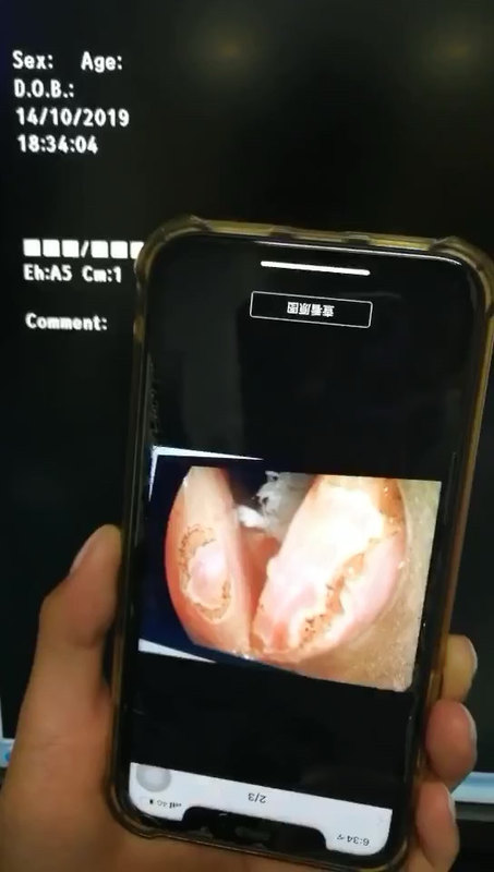 視頻封面