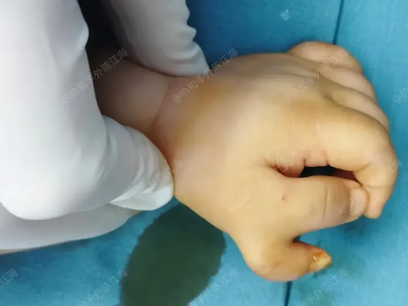 圖文圖片