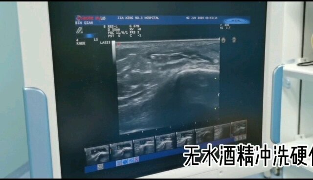視頻封面