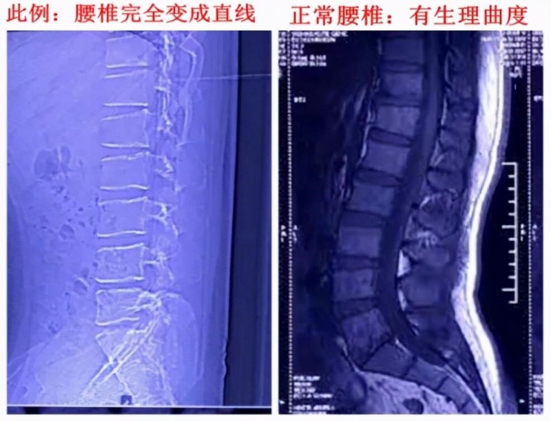 圖文圖片