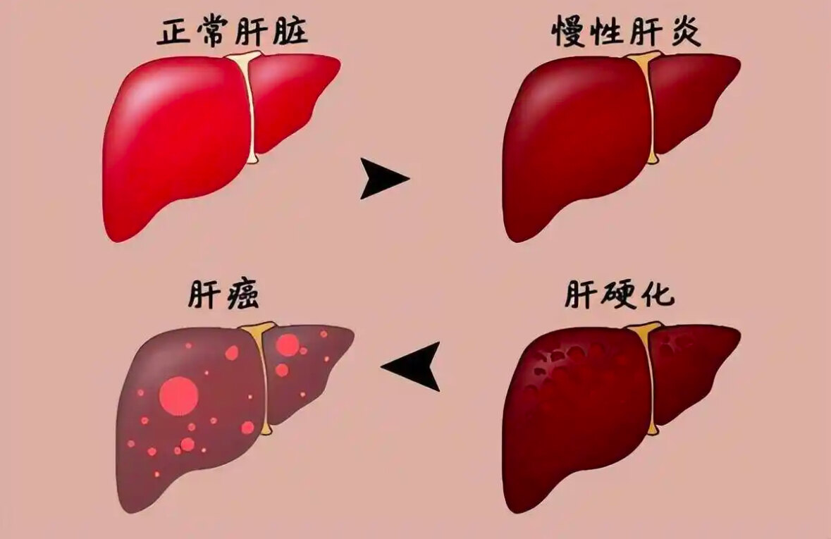 圖文圖片