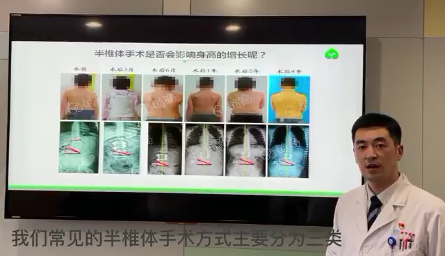視頻封面