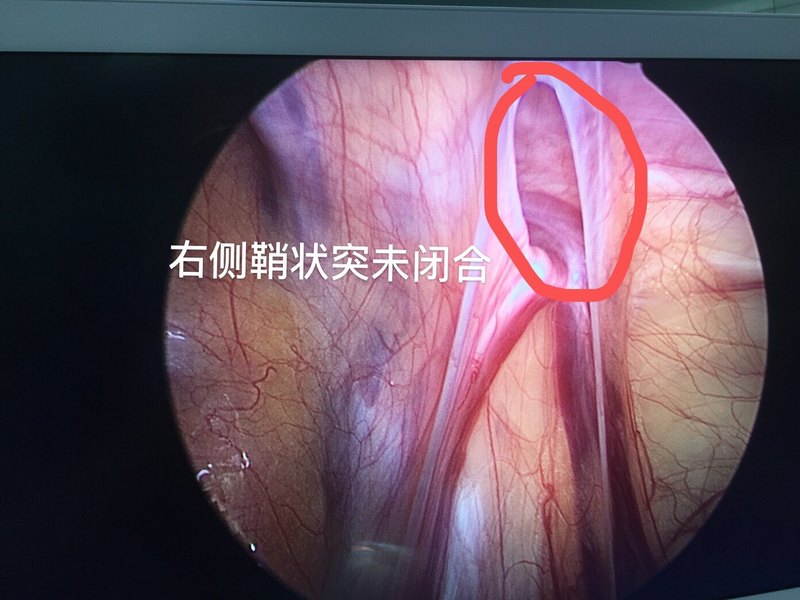 圖文圖片