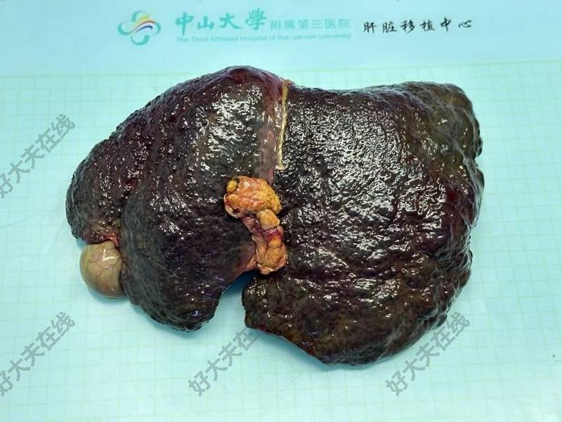 圖文圖片