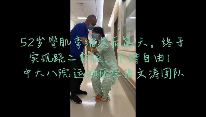 臀肌挛缩关节镜术后实现跷二郎腿，下蹲自由
