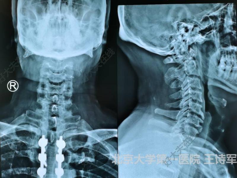 圖文圖片