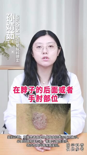 視頻封面