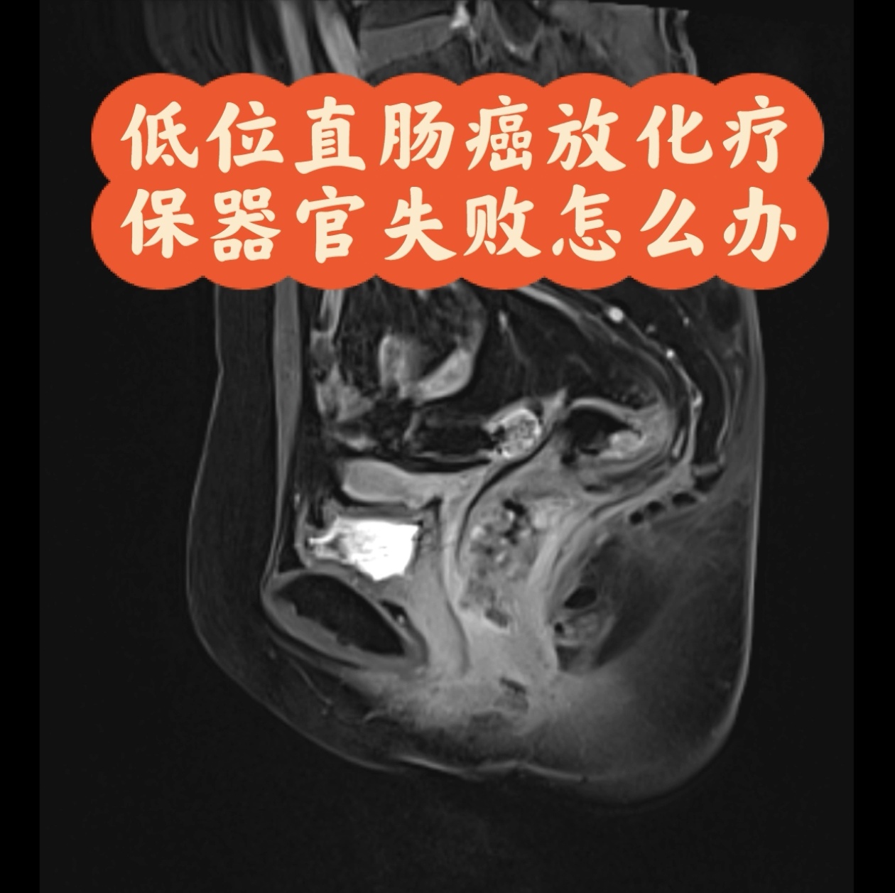 圖文圖片