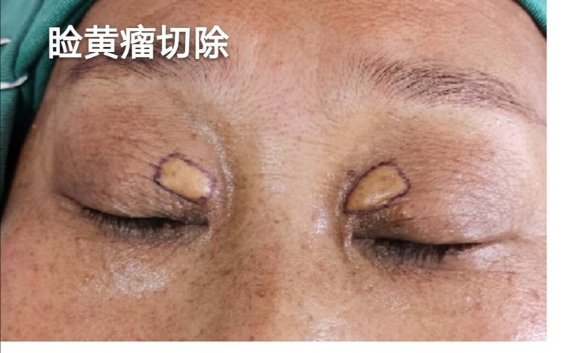 圖文圖片