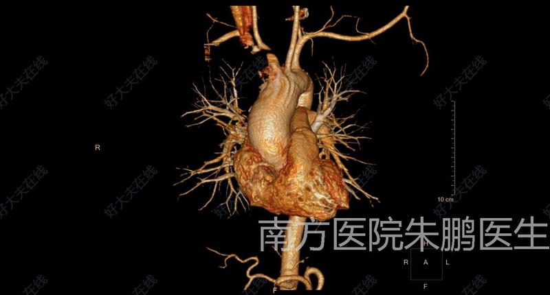 圖文圖片