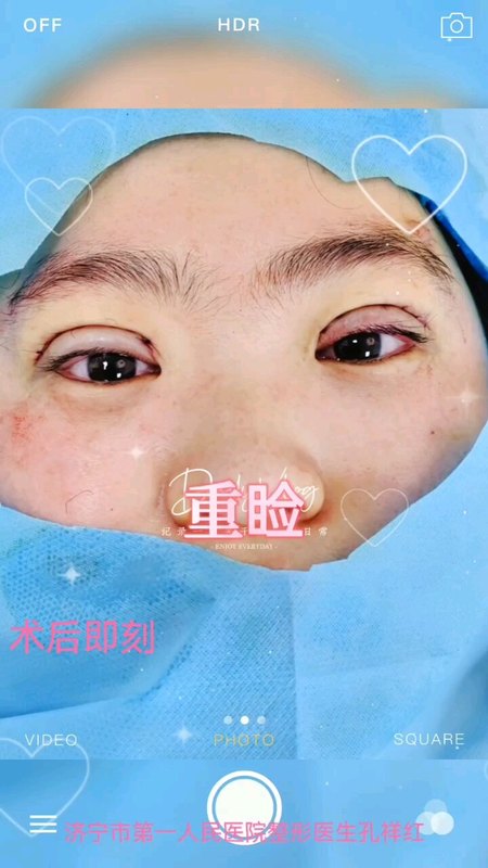 視頻封面