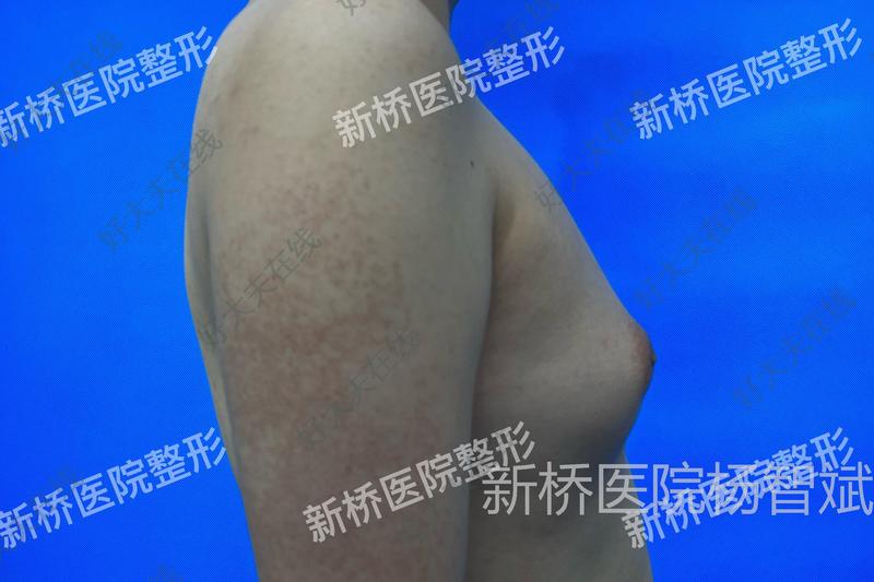 圖文圖片