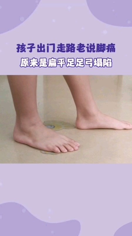 孩子出门走路老说脚痛，原来是扁平足足弓塌陷！