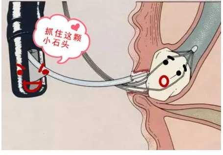 圖文圖片