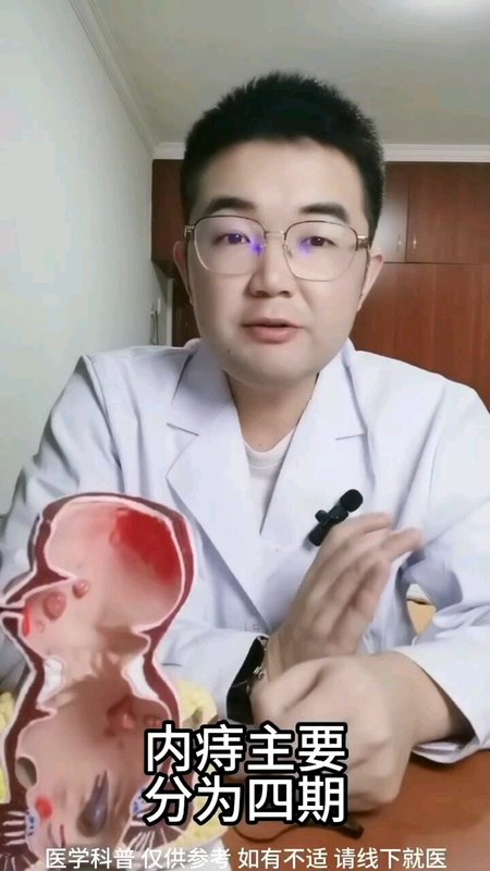 你的痔疮是几期了？