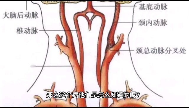 視頻封面