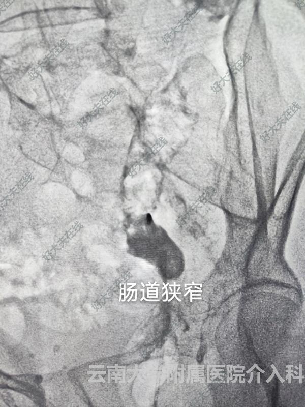 圖文圖片