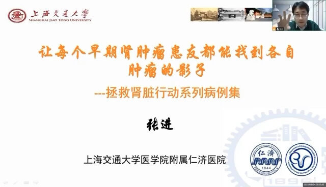 仁济医院张主任谈复杂肾脏肿瘤保肾—病例2
