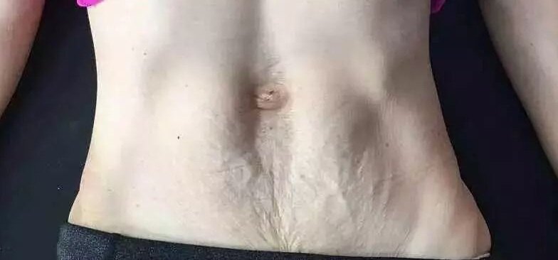 圖文圖片