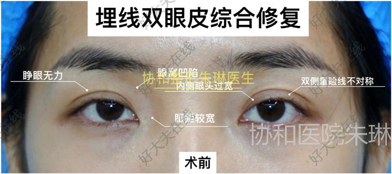 圖文圖片