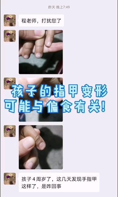 視頻封面