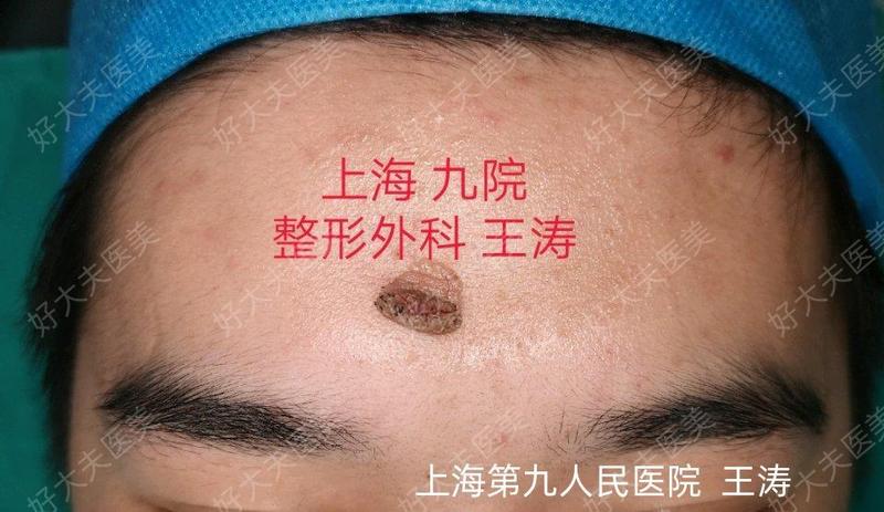 圖文圖片