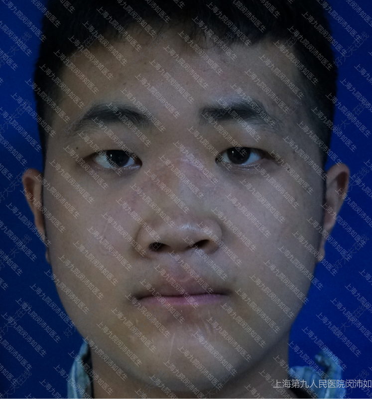 圖文圖片