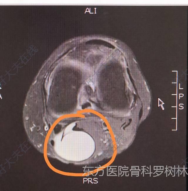 圖文圖片